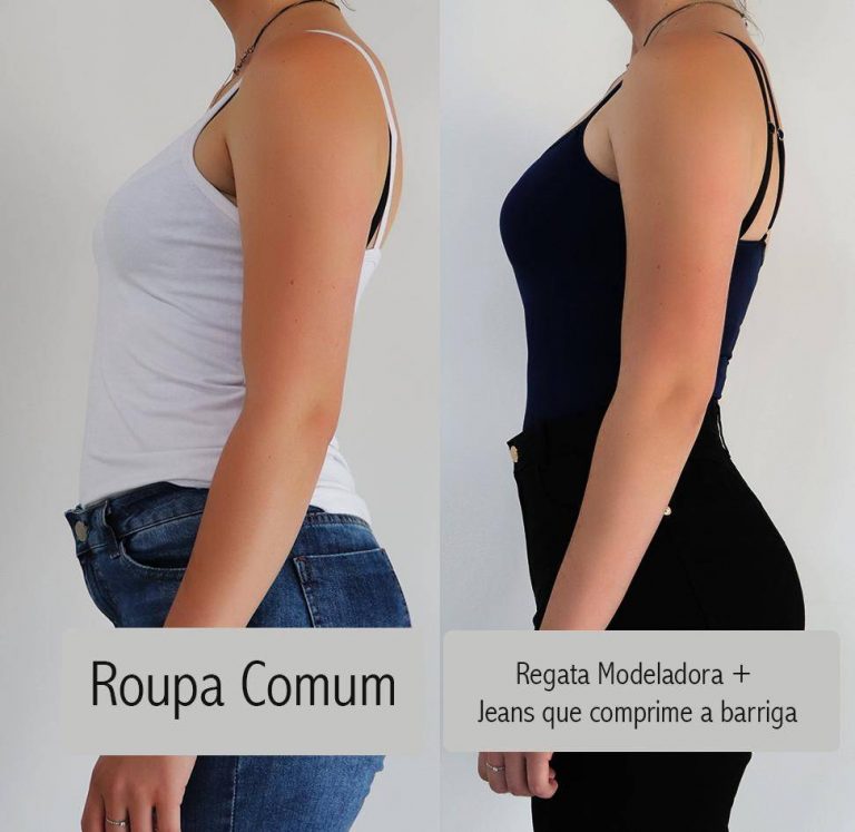 Antes E Depois Modeladores Modab Modab Blog 4659